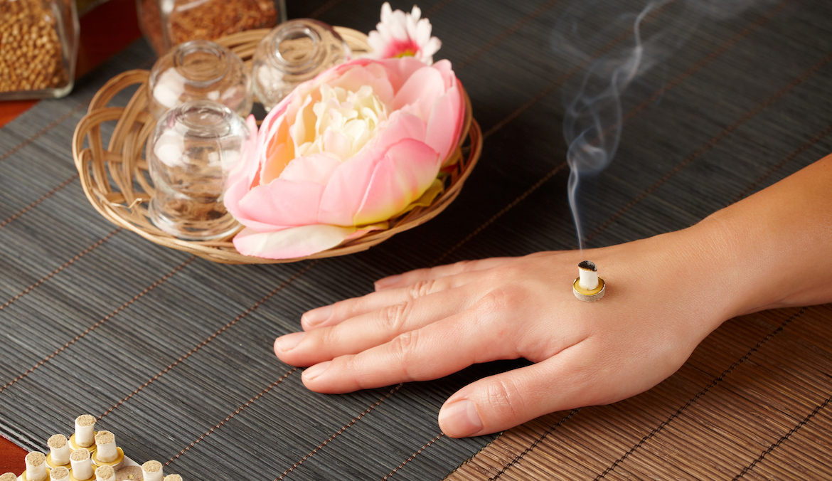 Moxibustion brings the benefits of acupuncture — and more