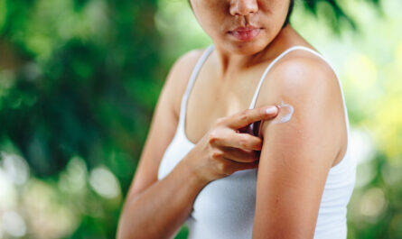 6 Home Remedies for Bug Bites Dermatologists Recommend